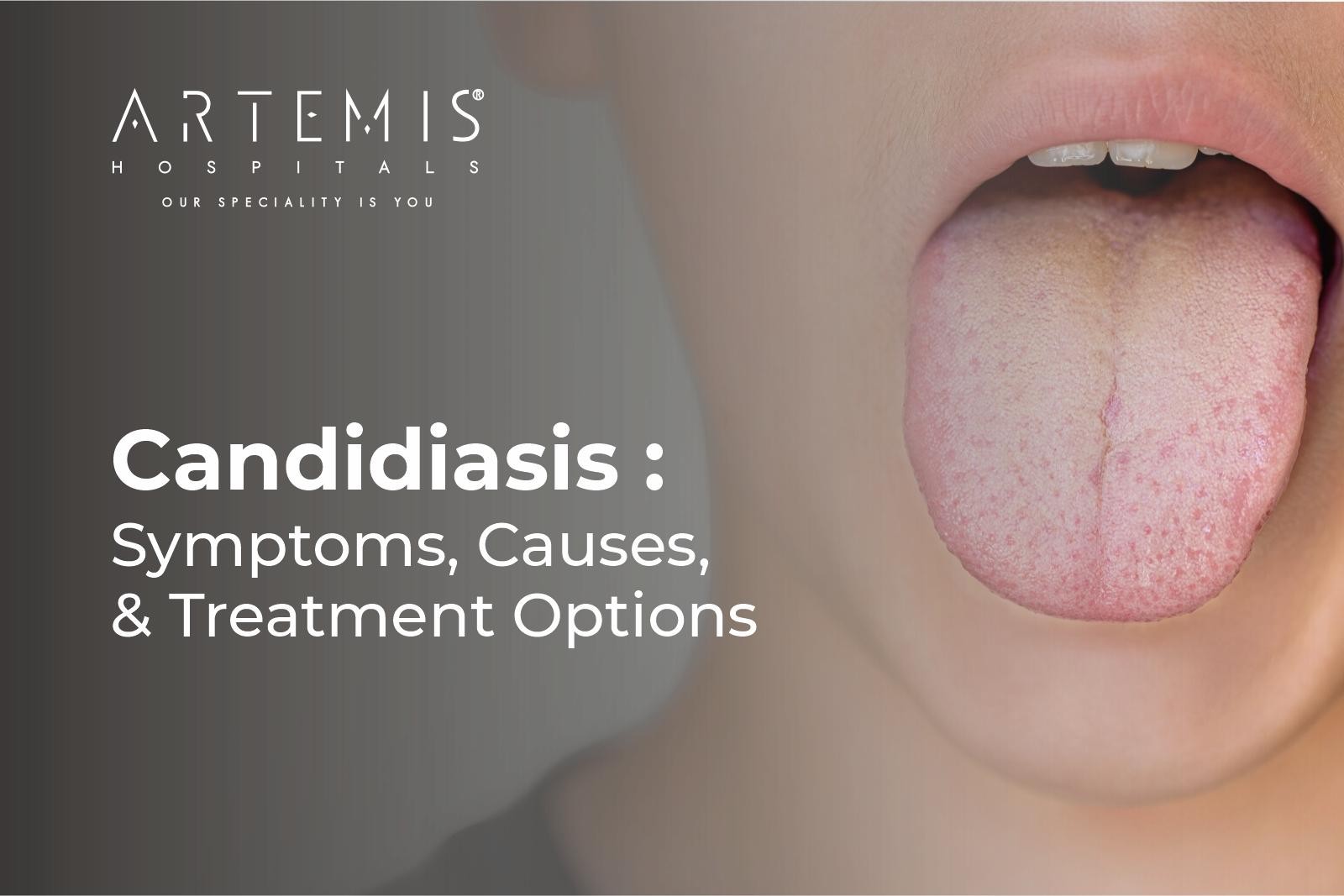 Candidiasis Symptoms
