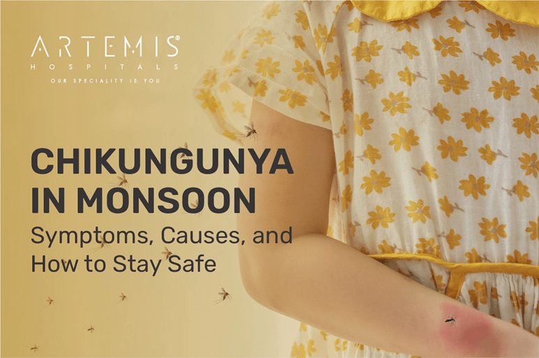 Chikungunya Symptoms