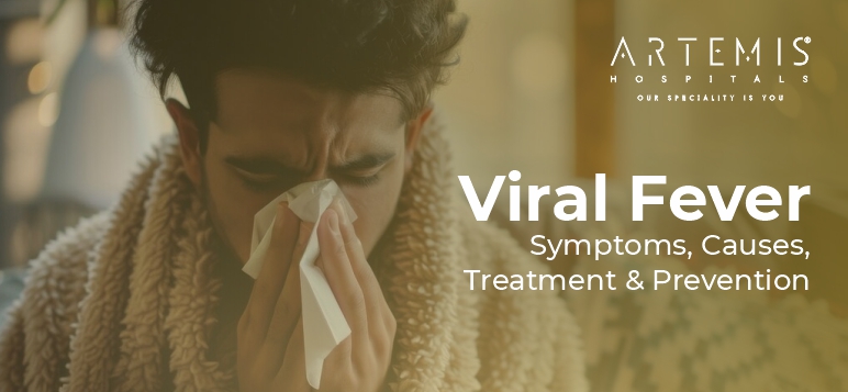 Viral fever overview
